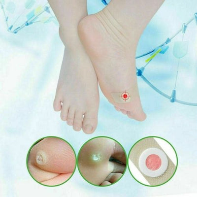 Corn Foot Patch Plantar Thorn Remove Foot Corn Removal Plaster Soften Skin CA