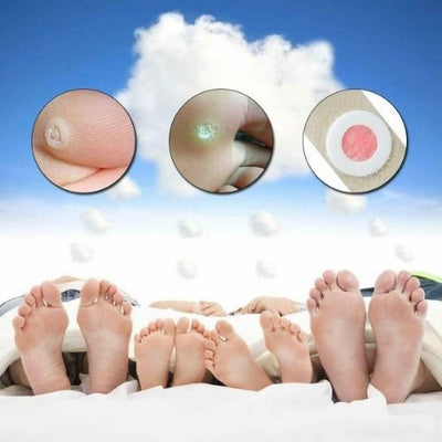 Corn Foot Patch Plantar Thorn Remove Foot Corn Removal Plaster Soften Skin CA