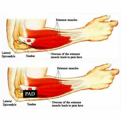 Tennis Elbow Brace Strap Tendonitis Golfers Gel Band Golf Pain Relief Support
