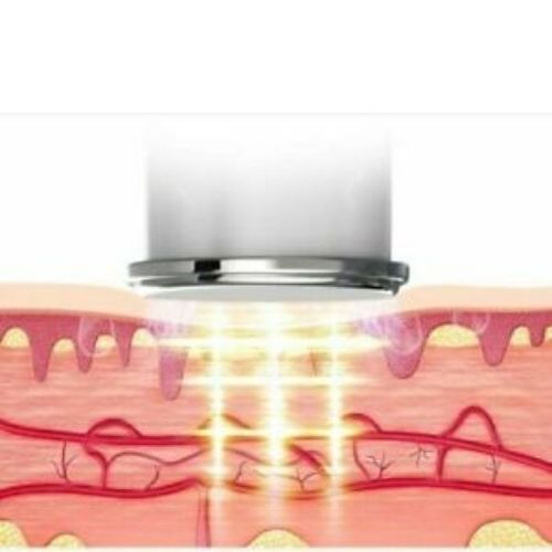 4 Head Neck Massager For Neck And Shoulder Pain Relief Muscle Relaxation Vibrate