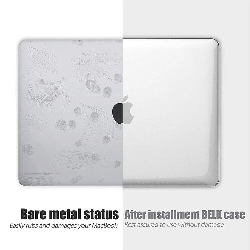 MacBook Pro 13" A2159 A1989 A1708 Clear Case + Keyboard Cover + Screen Protector
